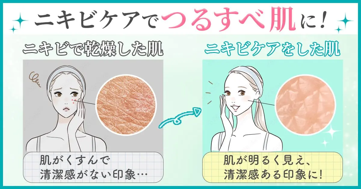 画像に alt 属性が指定されていません。ファイル名: %E3%83%8B%E3%82%AD%E3%83%93%E5%8C%96%E7%B2%A7%E6%B0%B4%E3%83%99%E3%83%8D%E3%83%95%E3%82%A3%E3%83%83%E3%83%88%E3%83%90%E3%83%8A%E3%83%BC.webp