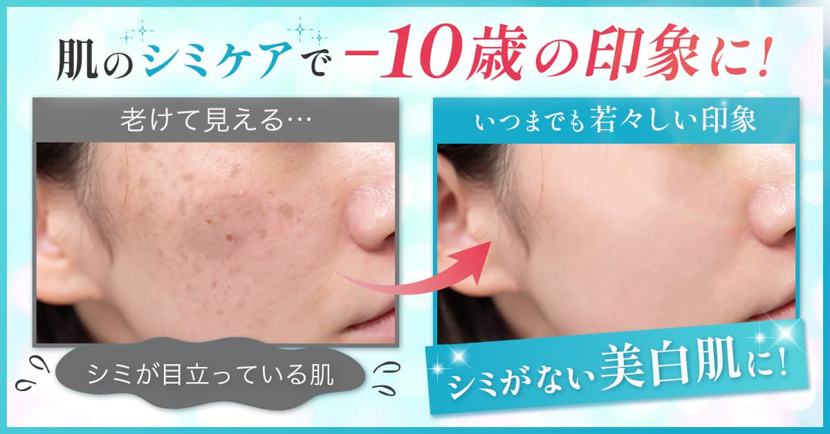 肌のシミケア