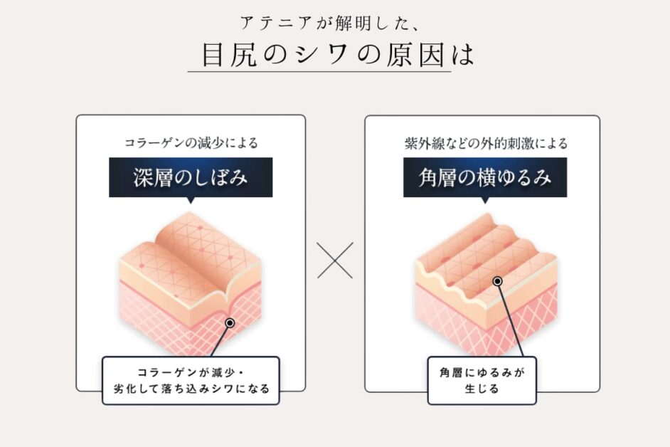 目尻のシワの原因